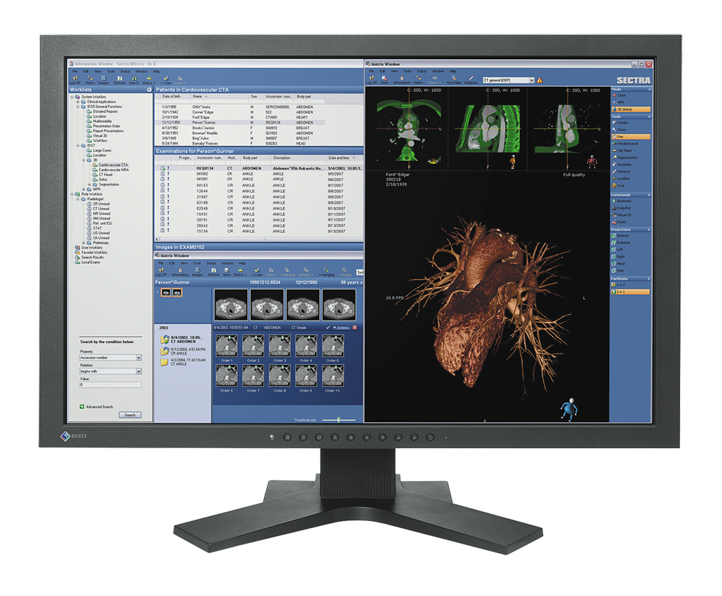 Mckesson Pacs Viewer Monitors